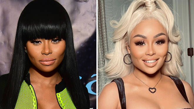 Blac Chyna Accused Of Having Plastic Surgery After Showing 'New Face'